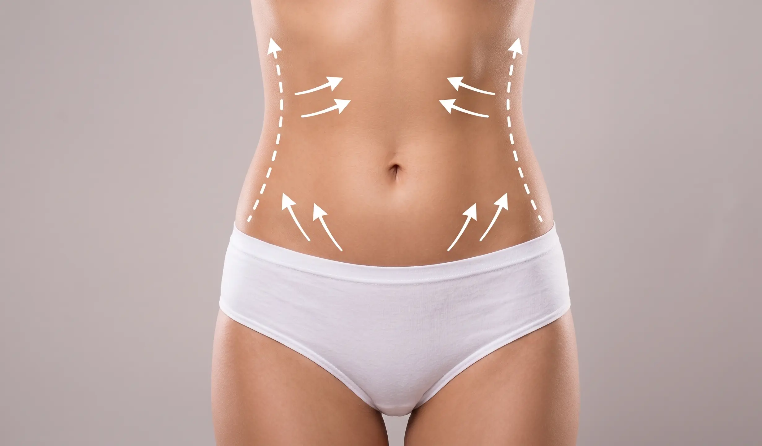 Abdominoplastie