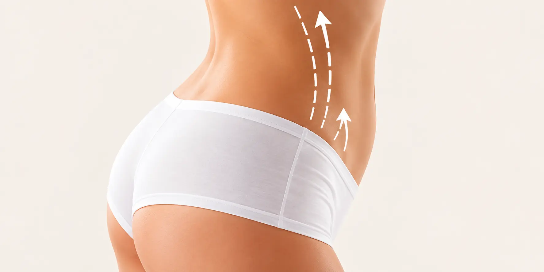 Chirurgie post-amaigrissement
