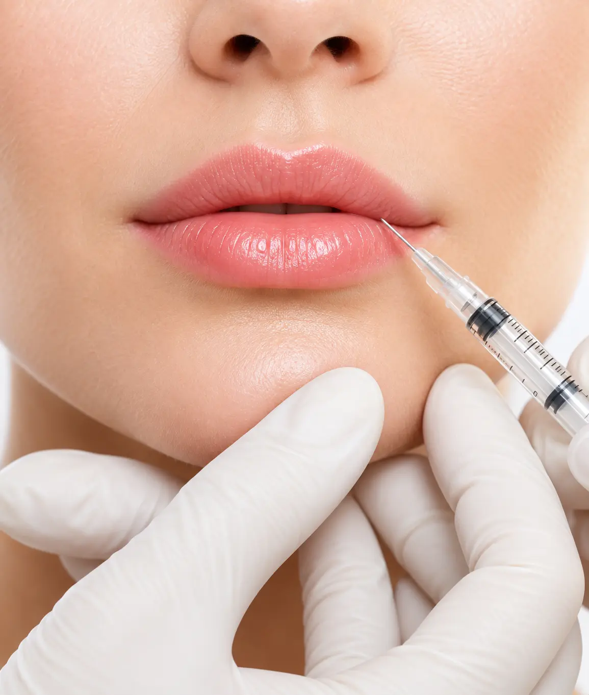 Injection de produit de comblement du visage