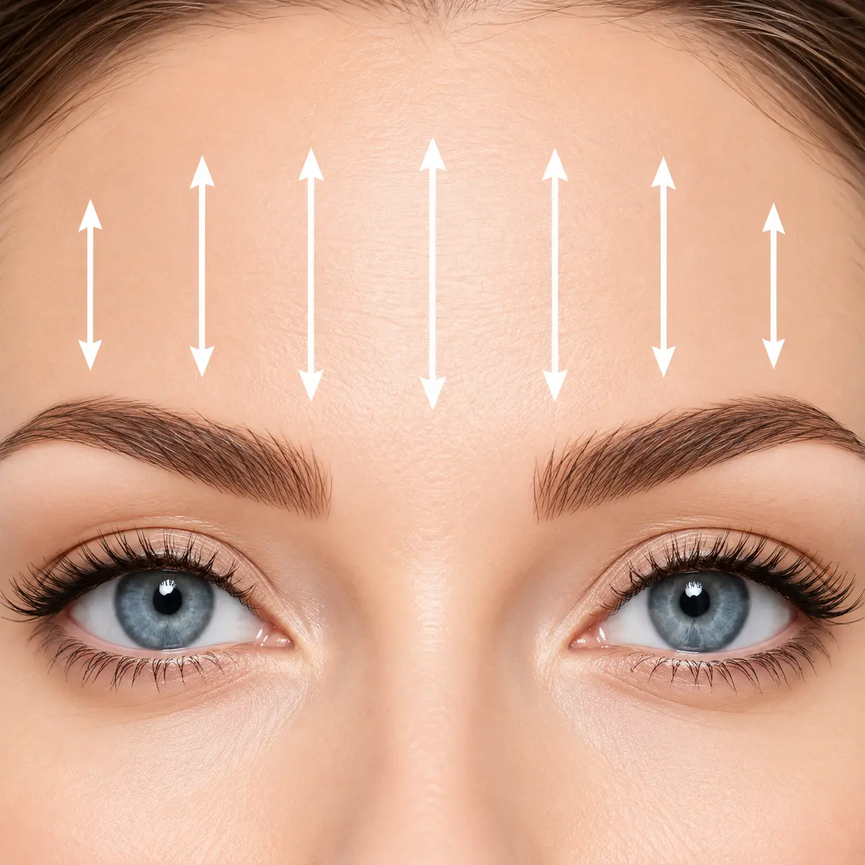 Injection de toxine botulique pour le visage